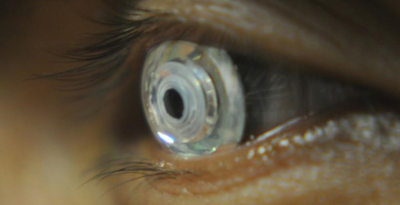 zoom-contact-lenses