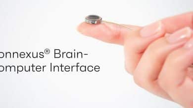 Connexus implant cerebral