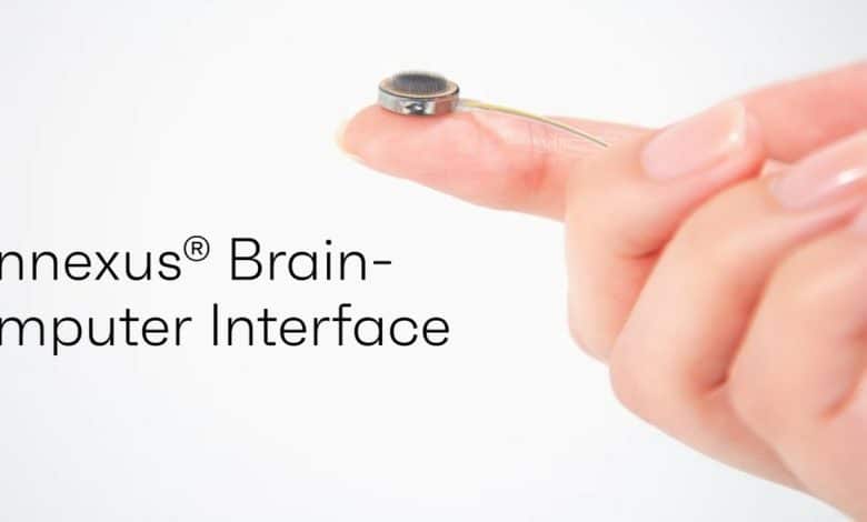 Connexus implant cerebral